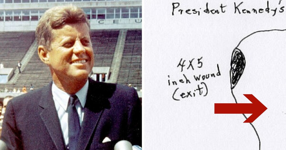 JFK Surgeon’s Drawing Claims Assassinated President Was Shot Twice